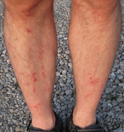 photo of scrapes and cuts on legs after Warrior Dash